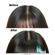 L'Oreal Professionnel Scalp Advanced Anti-Oiliness Dermo Purifier Shampoo 1500ml