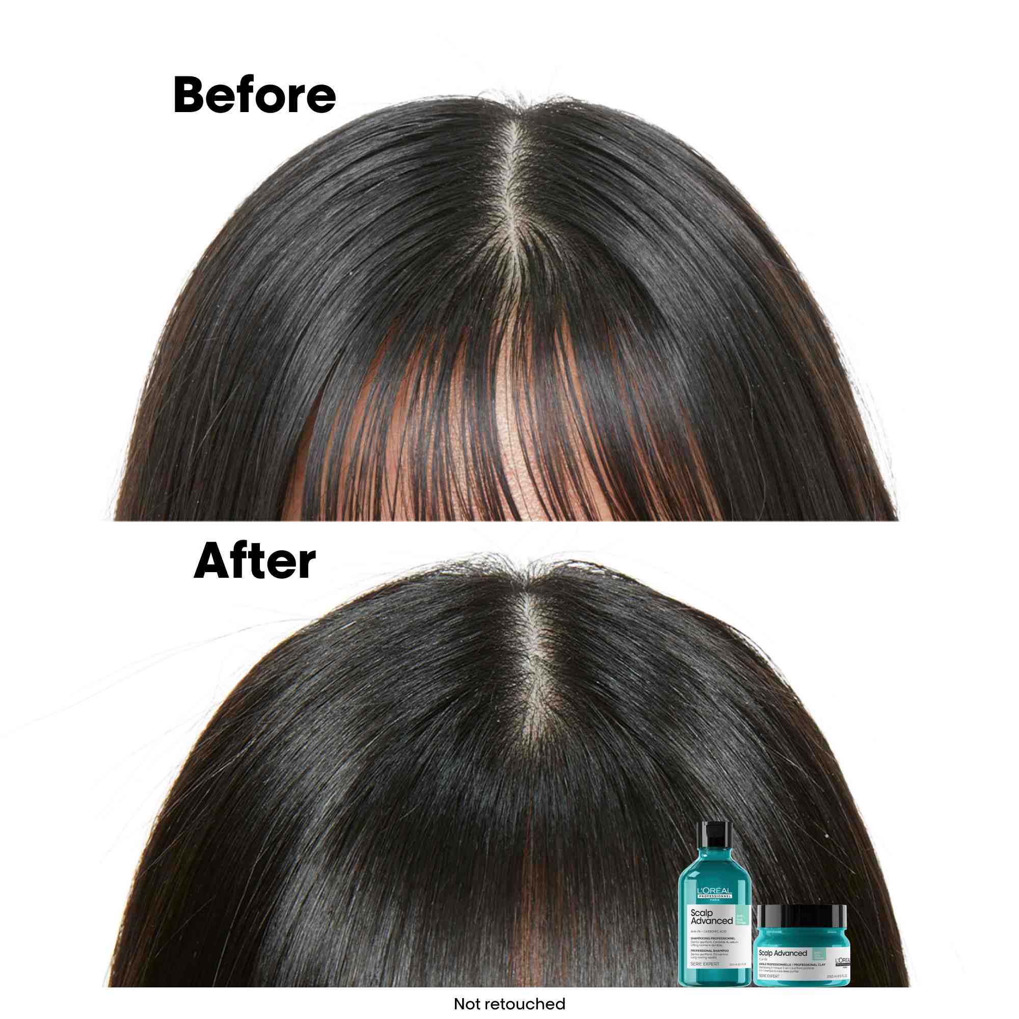 L'Oreal Professionnel Scalp Advanced Anti-Oiliness Dermo Purifier Shampoo 1500ml