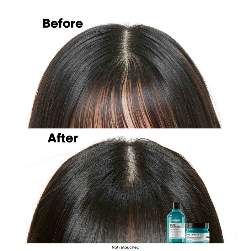 L'Oreal Professionnel Scalp Advanced Anti-Oiliness Dermo Purifier Shampoo 1500ml