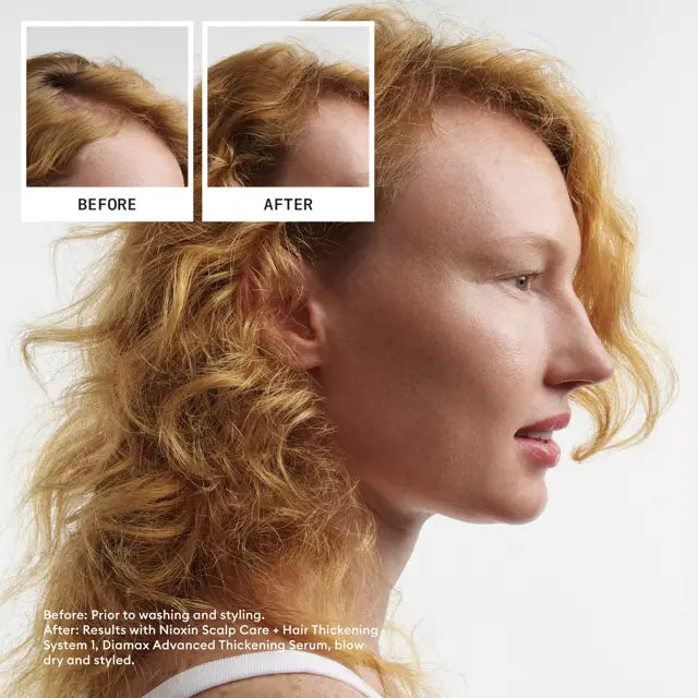 Nioxin System 1 Hair Starter Kit Natural Hair Light Thinning