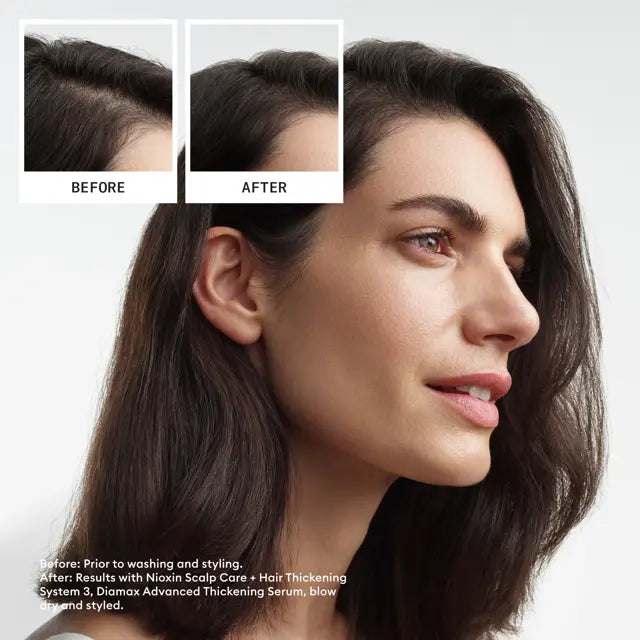 Nioxin System 3 Kit Colour Treated Hair Light Thinning